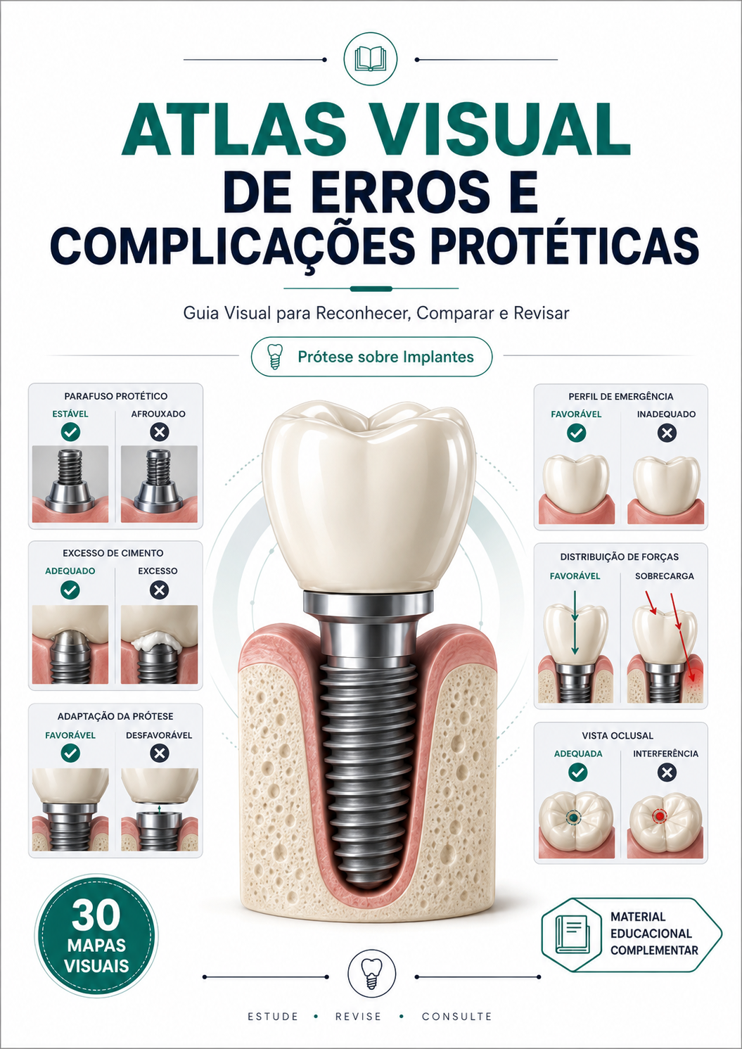Capa do Guia Visual de Componentes Protéticos